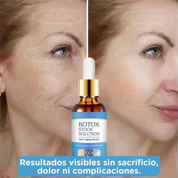 BOTOX STOCK SOLUTION -  PIEL MÁS JOVEN Y SIN ARRUGAS