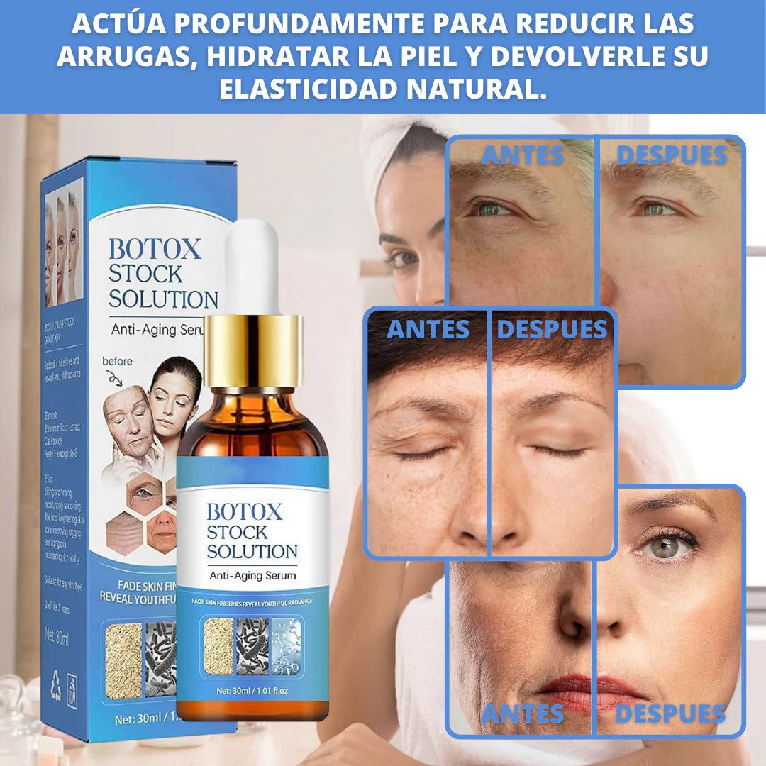 BOTOX STOCK SOLUTION -  PIEL MÁS JOVEN Y SIN ARRUGAS